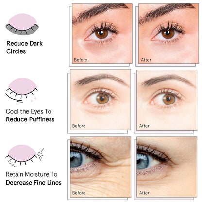 Instant Firming Collagen Eye Patches™