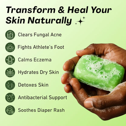 Calyra™ Antifungal Relief Bar
